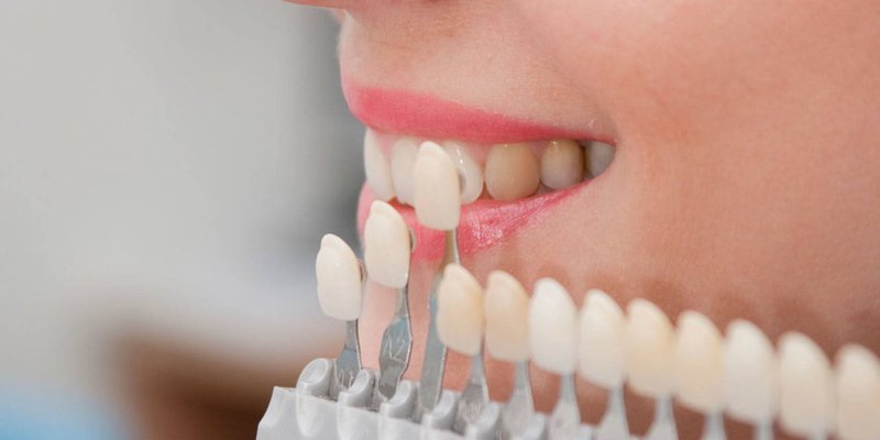 Dentissimo Smile Clinique - Servicii stomatologice